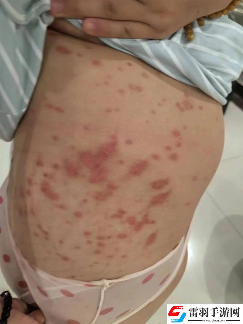 科技狂潮下的皮膚疙瘩謎團(tuán)