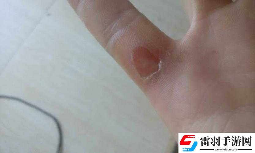 手指劃入縫隙挖水